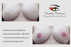 Areola medicínske tetovanie permanentného make-upu Veronika Kocianová