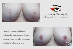 Areola tetovanie permanentného make-upu medicínska mikropigmentácia Veronika Kocianová