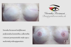Permanentný make-up esteticko medicínske tetovanie areola Veronika Kocianová Bratislava