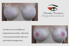 Permanentný make-up microblading tetovanie areola prsné dvorce a bradavky Veronika Kocianová 