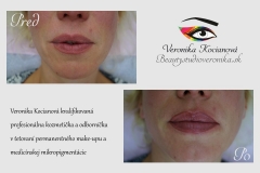 Tetovanie permanentného make-upu pier Veronika Kocianová
